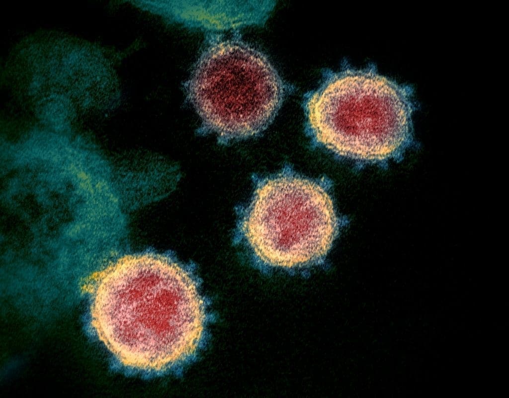 This transmission electron microscope image shows SARS-CoV-2—also known as 2019-nCoV, the virus that causes COVID-19—isolated from a patient in the U.S. Virus particles are shown emerging from the surface of cells cultured in the lab. The spikes on the outer edge of the virus particles give coronaviruses their name, crown-like.